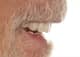 Slider image (10) Art Dental Care